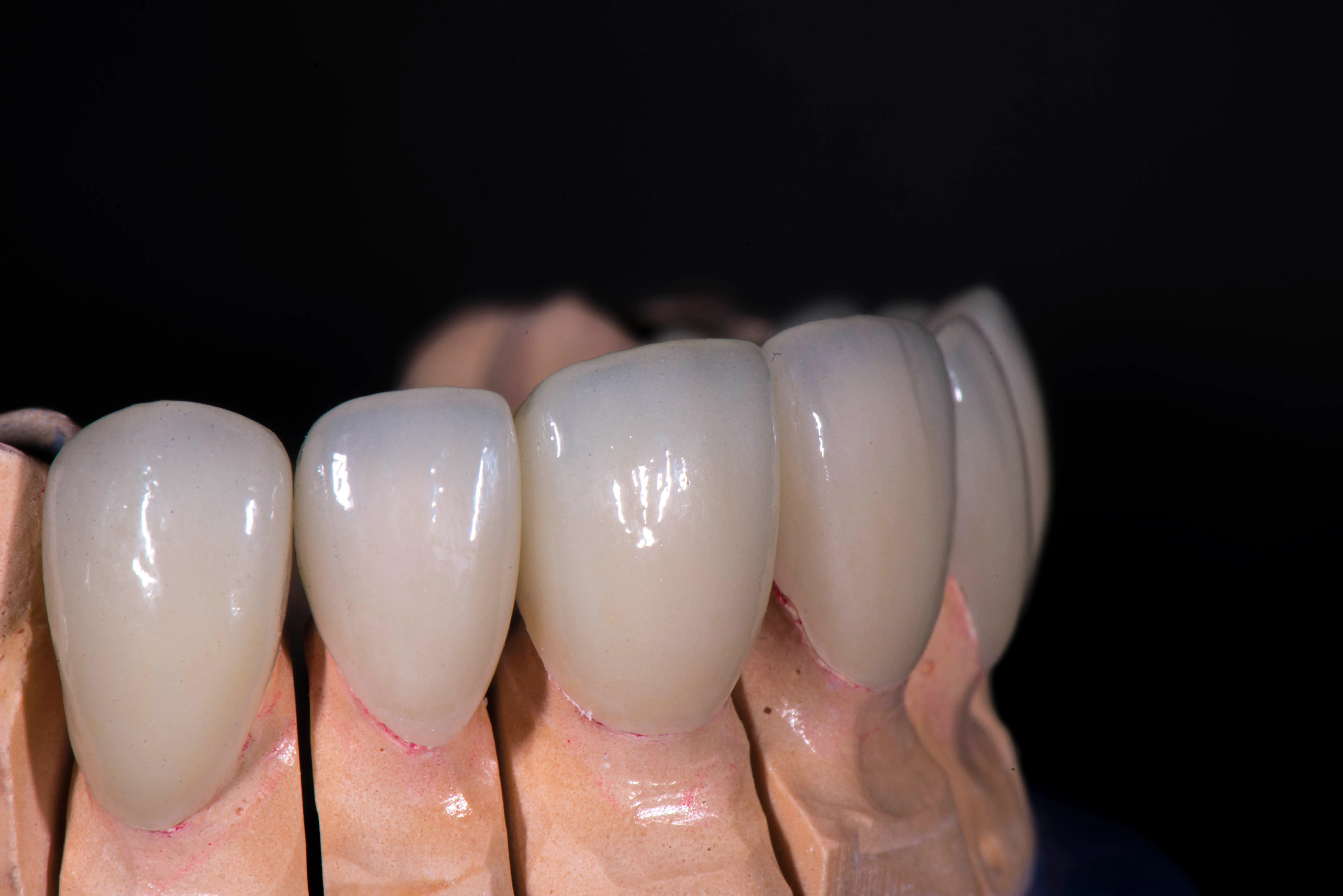 Marlton Dental Care Smile Gallery