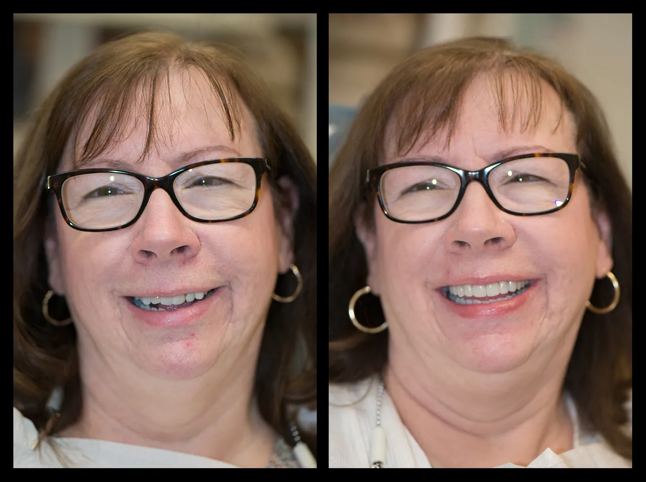 Marlton Dental Care Smile Gallery