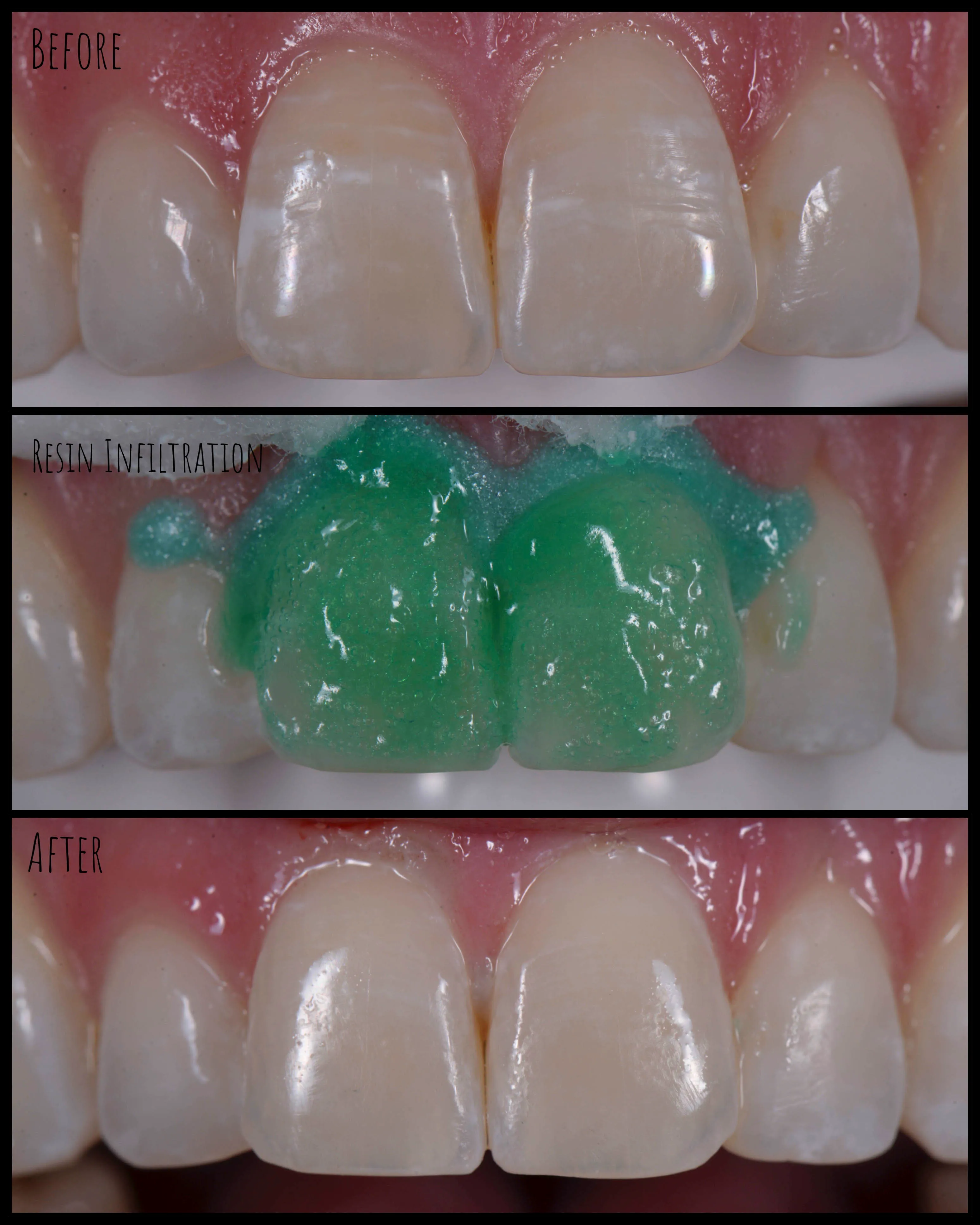 Marlton Dental Care Smile Gallery