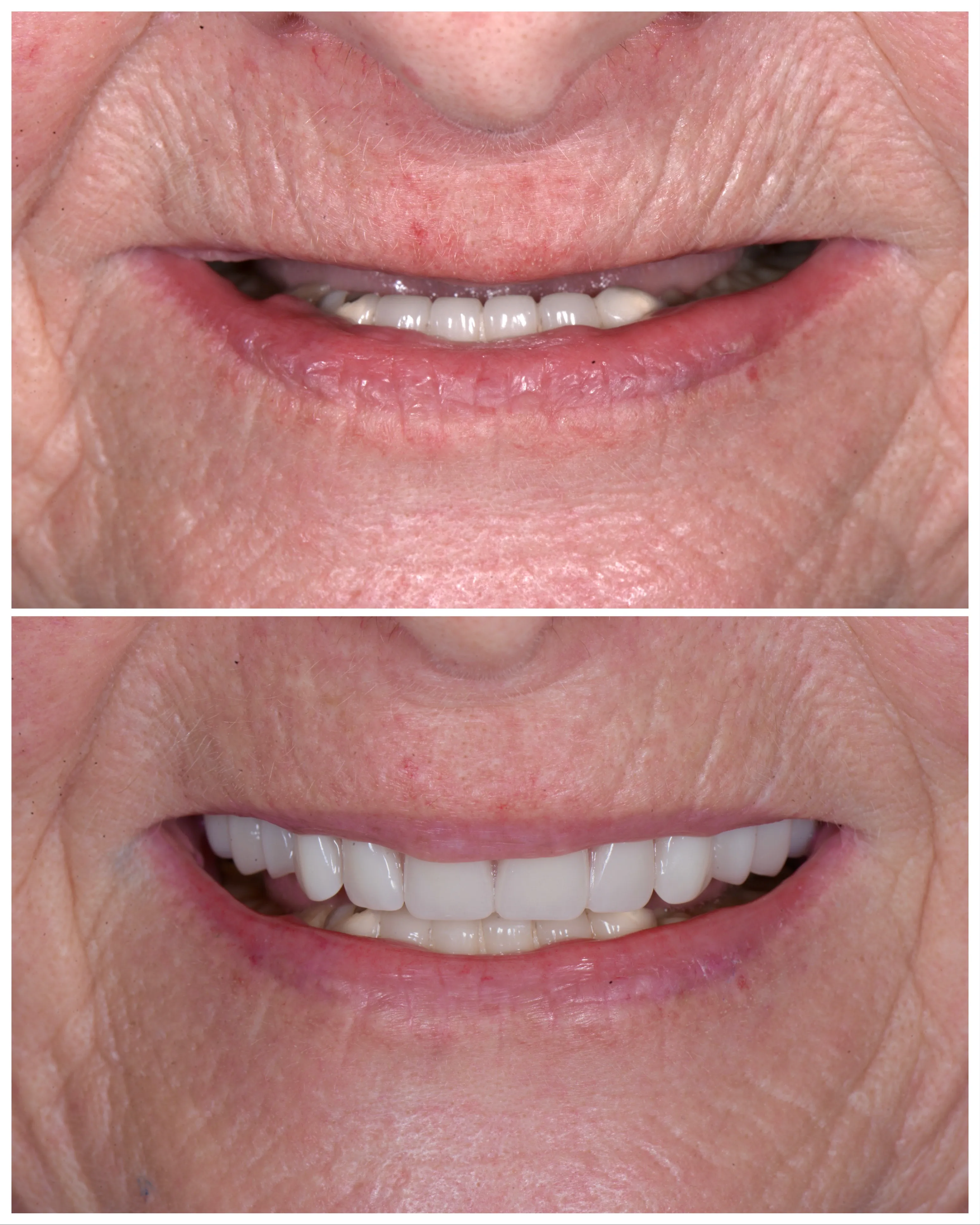 Marlton Dental Care Smile Gallery