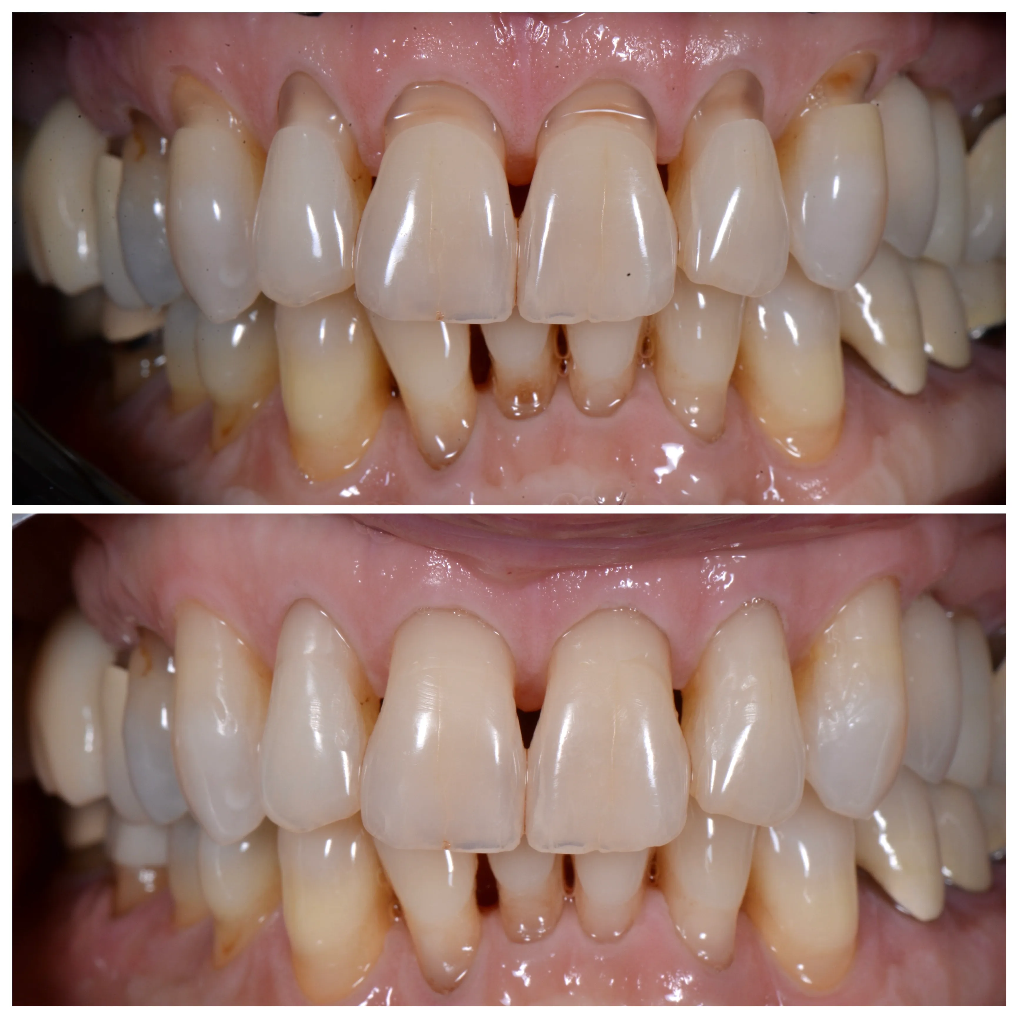 Marlton Dental Care Smile Gallery