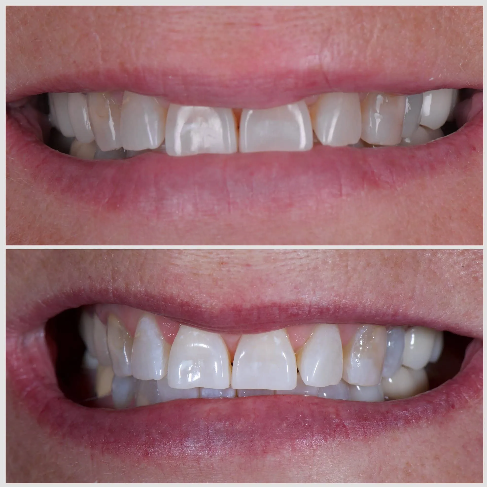 Marlton Dental Care Smile Gallery