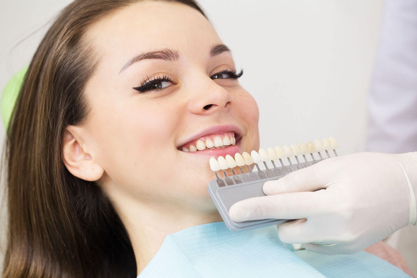 How Much Do Veneers Generally Cost?