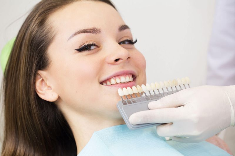 How Much Do Veneers Generally Cost?