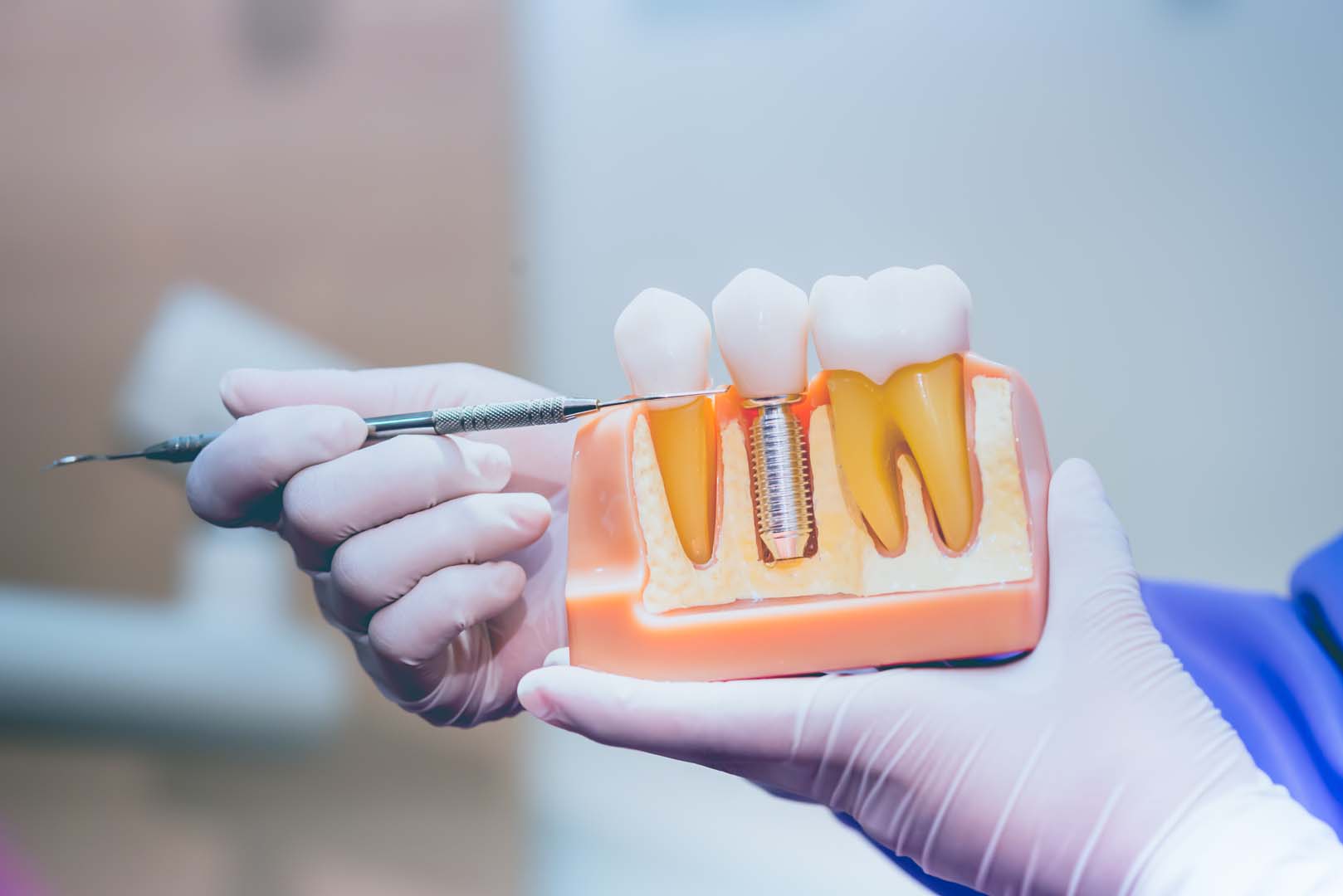 Dentist in Colleyville Azure Dental