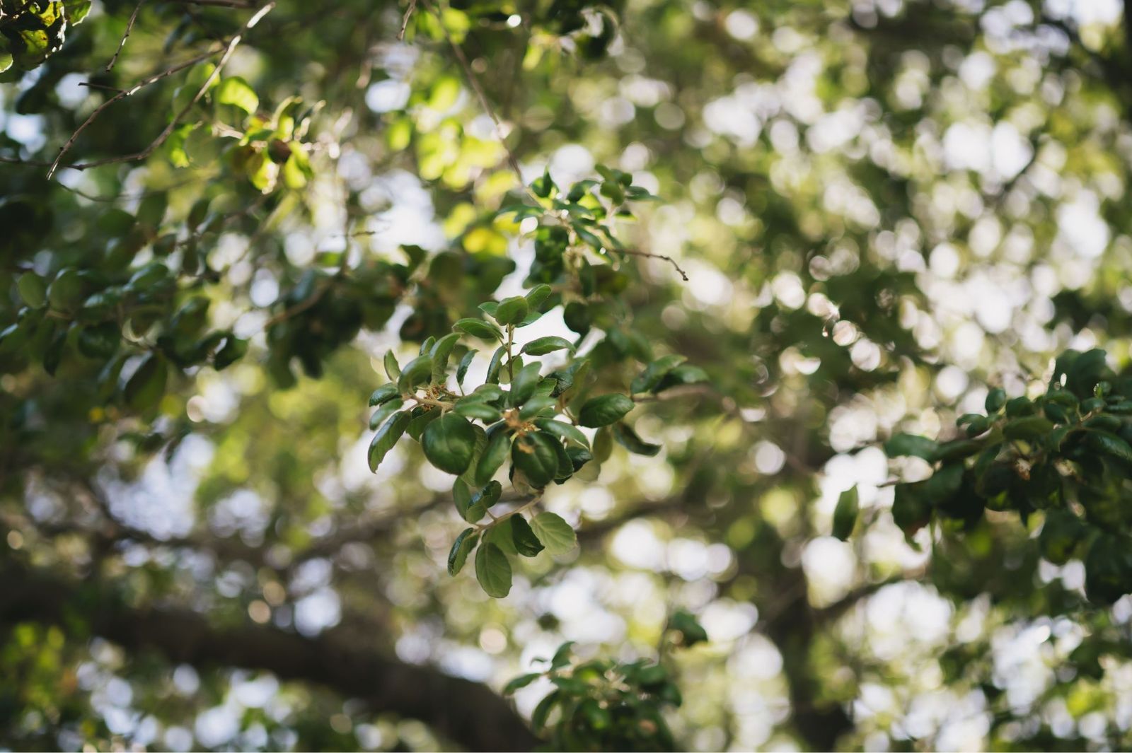 The Benefits of the SoproLife Intraoral Camera: Austin Brown, DDS ...